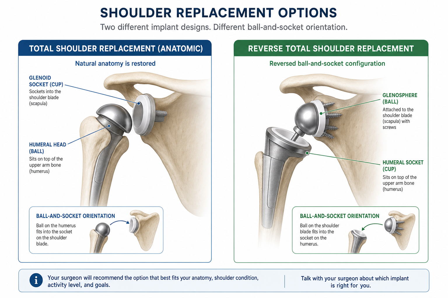 Comparison illustration of total shoulder replacement versus reverse total shoulder replacement implant designs