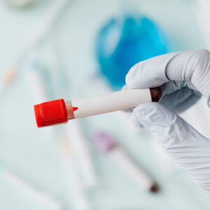 product10jpg  Varma Shoulder Institute