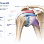 rotator cuff repair recovery timeline