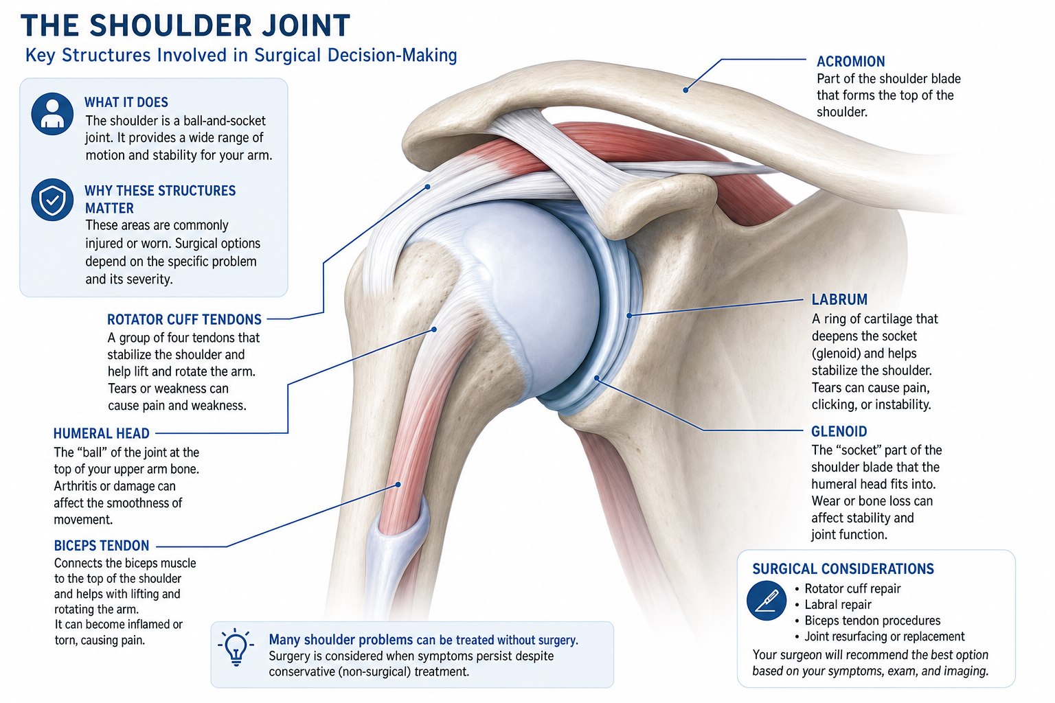 Illustration of shoulder anatomy reviewed during a surgical second opinion